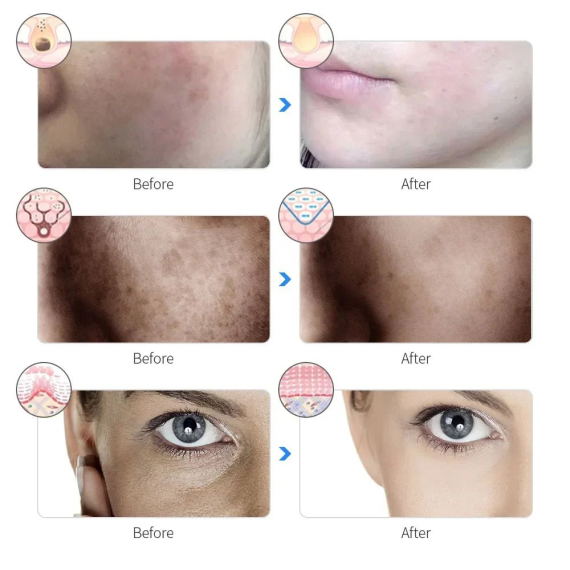 7-Color LED Photon Therapy Rechargeable Facial Mask - Skin Rejuvenation & Beauty Device